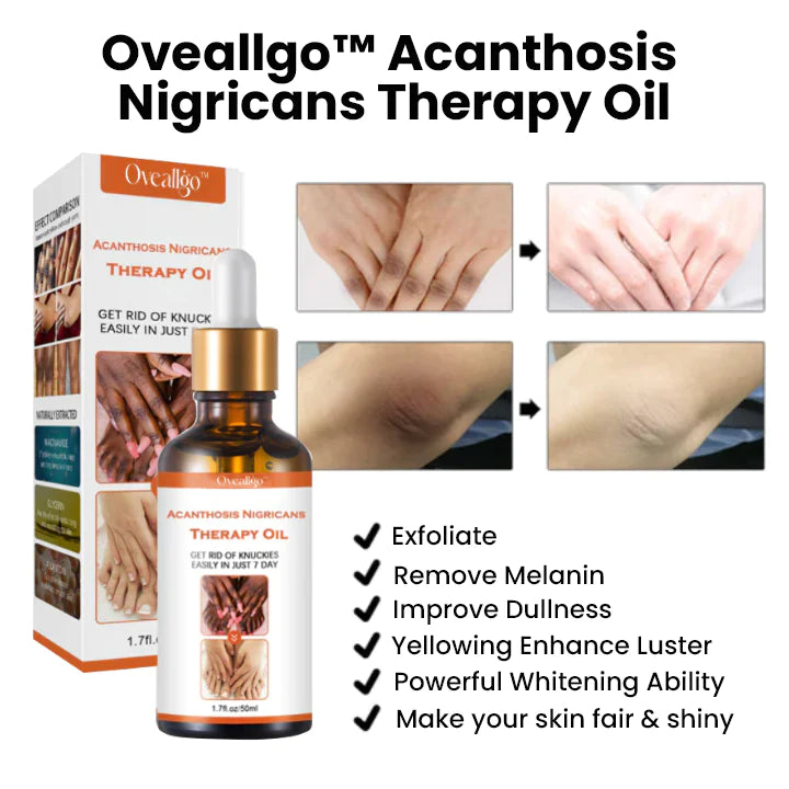 Oveallgo ™ زيت العلاج Acanthosis Nigricans